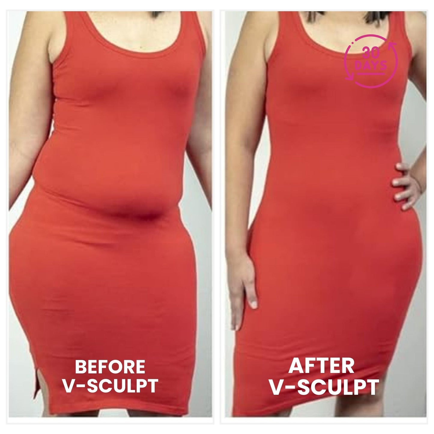 V-Sculpt | Confidence, Shape & Lift